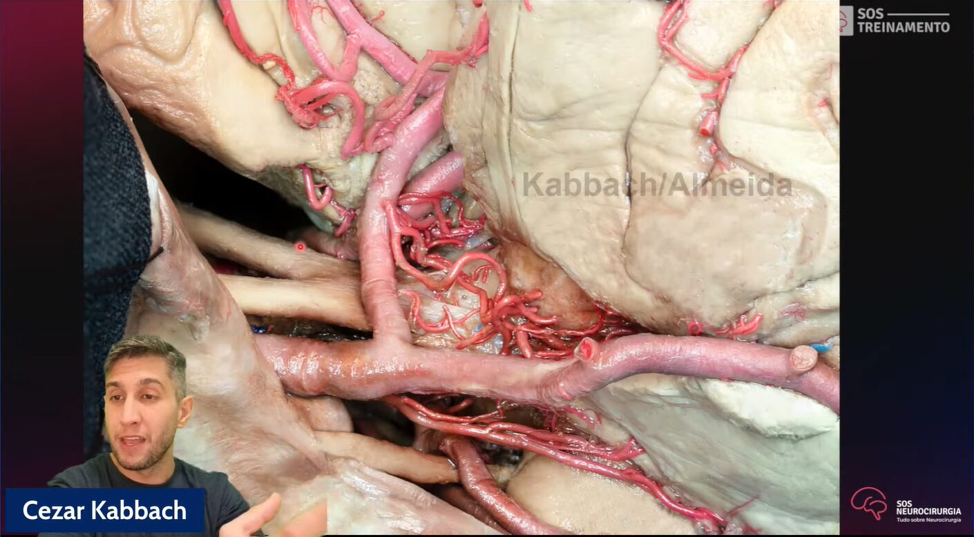 Masterclass Aneurismas na Prática: da Anatomia à Angiografia